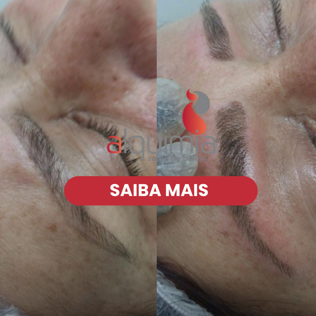Antes